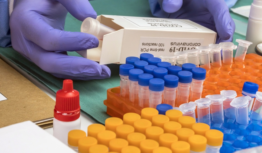 SepMate Tubes